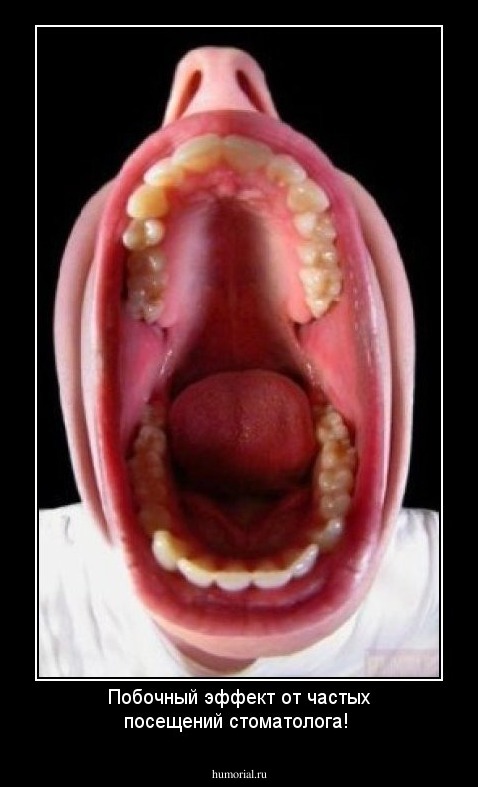 Побочный эффект от частых посещений стоматолога! 