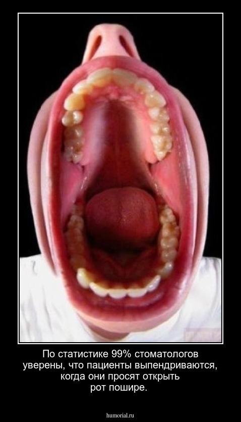 По статистике 99% стоматологов уверены, что пациенты выпендриваются, когда они просят открыть рот пошире.